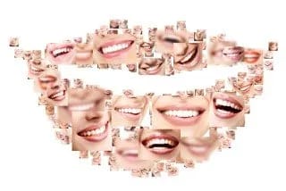 Change Your Smile Today with Same-Day Porcelain Veneers