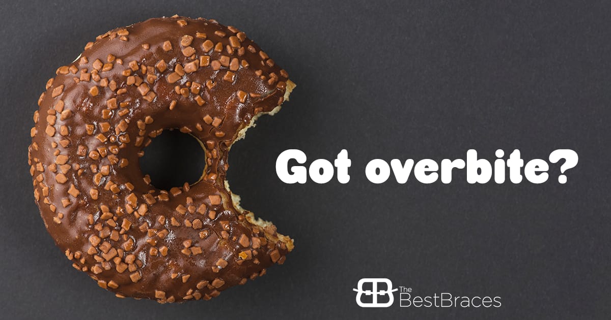 Do You Know If You Have a Deep Bite? Do You Know If You Have a Deep Bite?