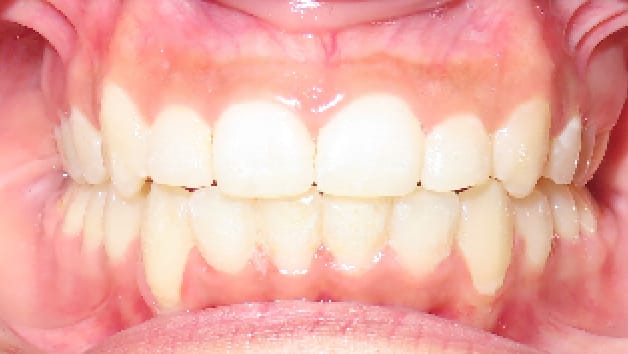 BF Ortho Smile Gallery After