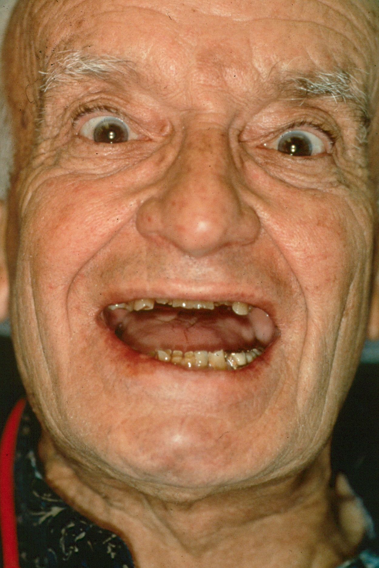 Rasner Smile gallery before 19