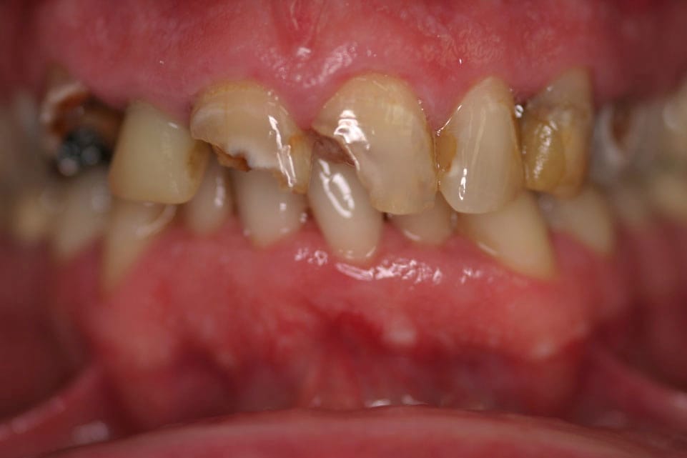 Rasner Smile gallery before 10
