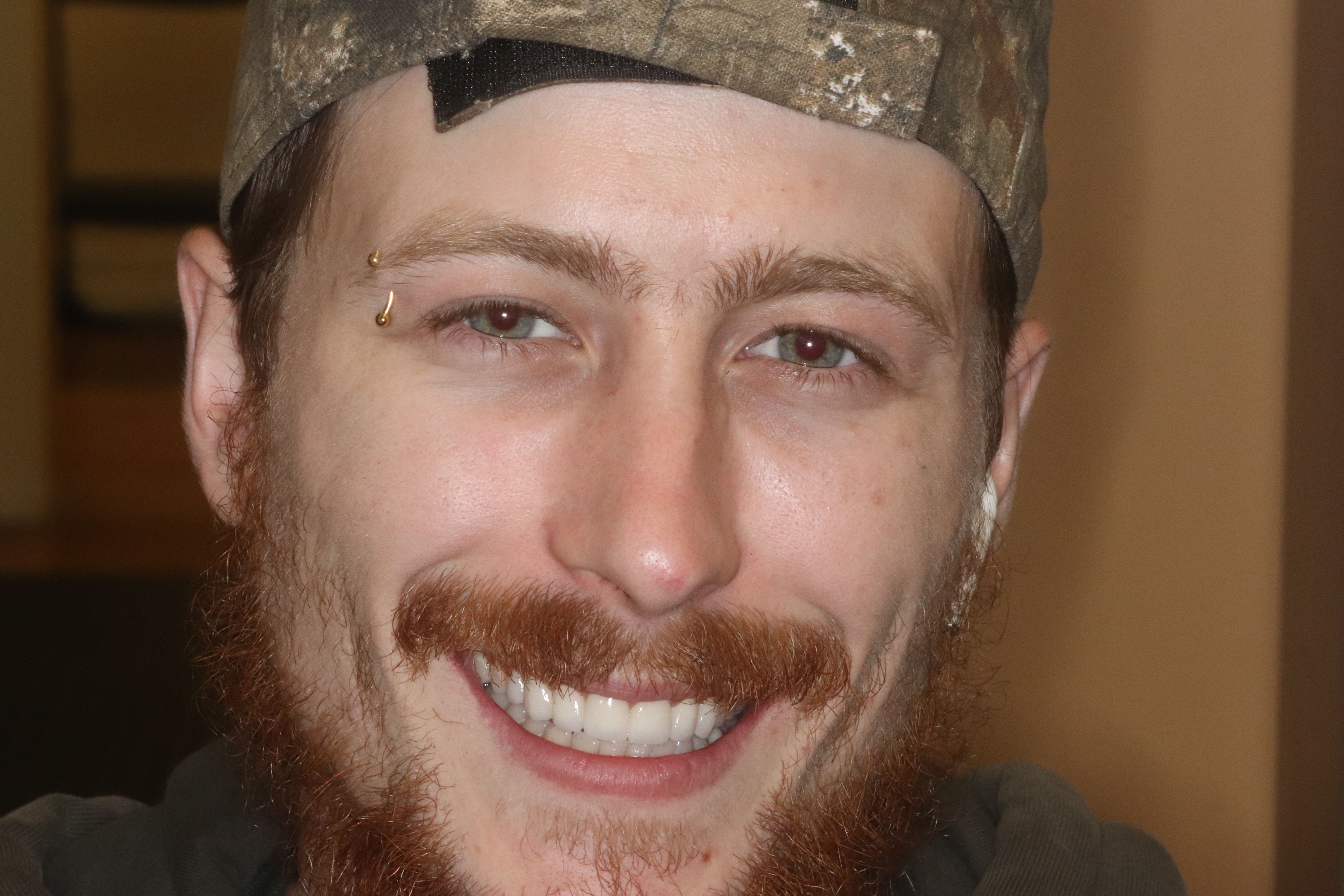 Rasner Smile gallery after 5