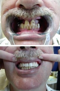 Before & After Walding and Associates
