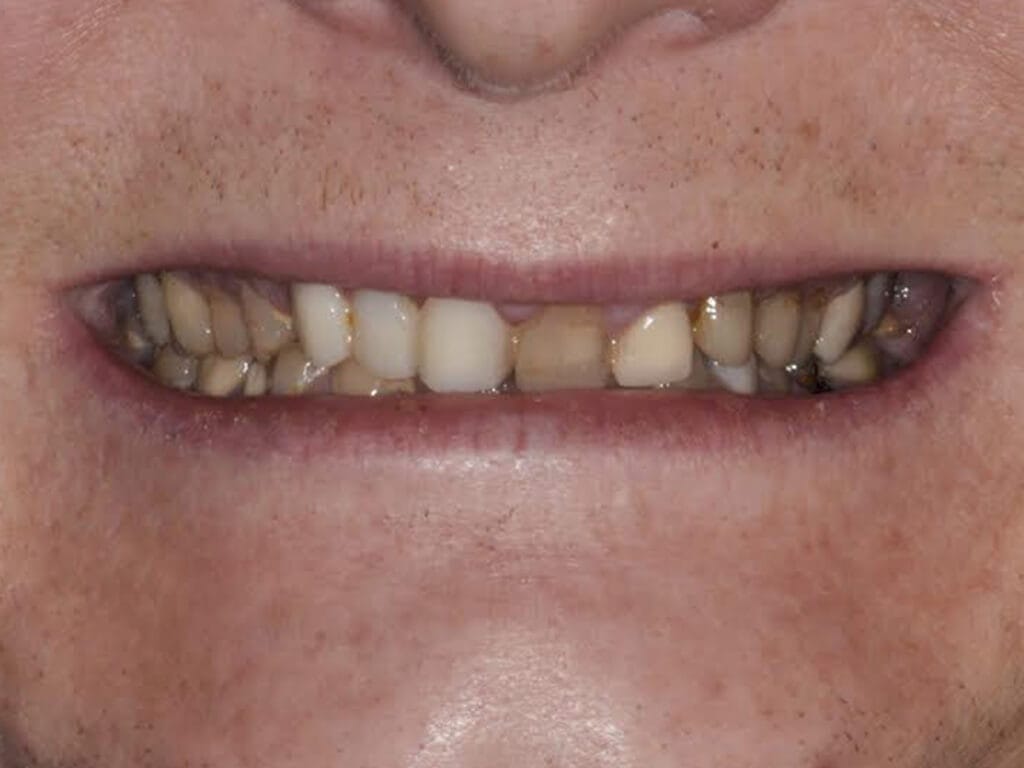 Virginia DC case 78 before