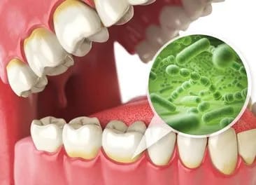 Bad Breath Dental Problem Dentist St Augustine