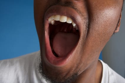 DRY MOUTH