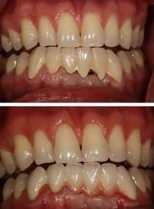 Before & After Walding and Associates