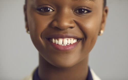 Seamless tooth replacement lady smiling