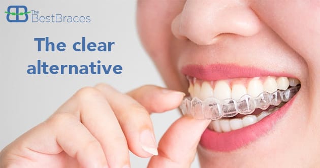 The Clear Alternative