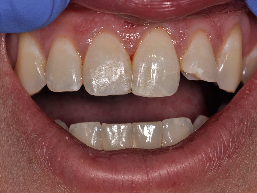 Virginia DC case 80 before