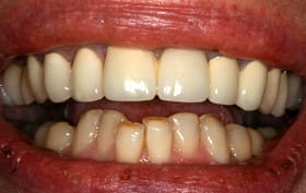 Smile Gallery - before