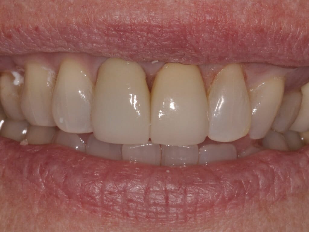 Virginia DC case 77 after