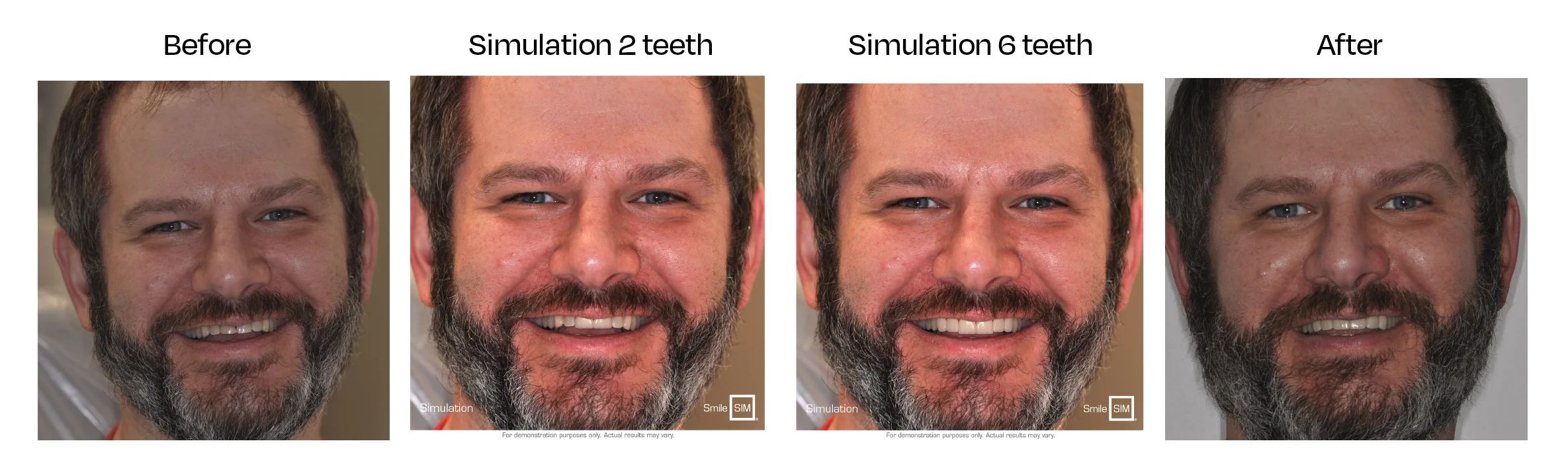 Elite Cosmetic Simulation