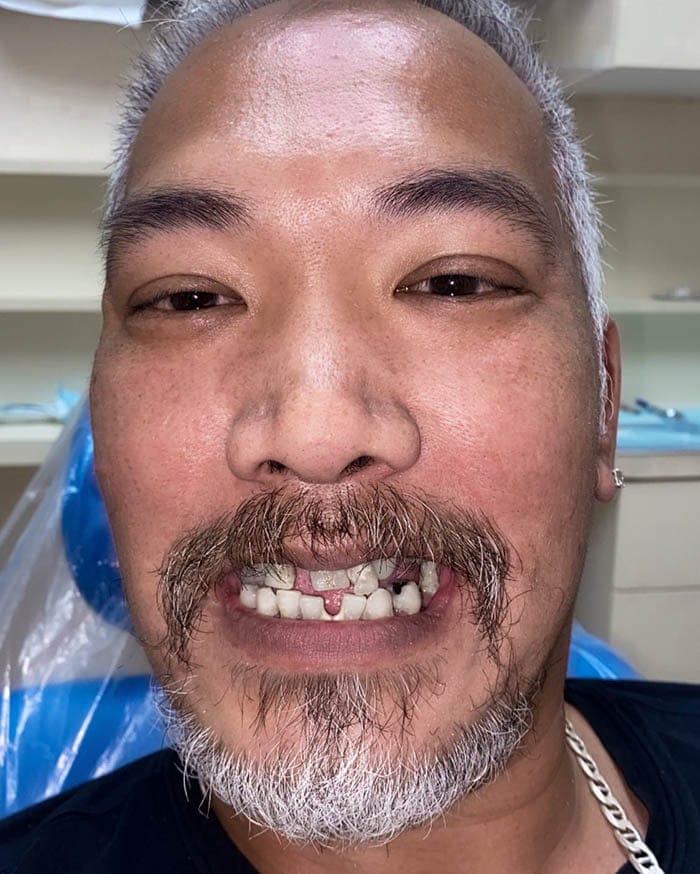 Before