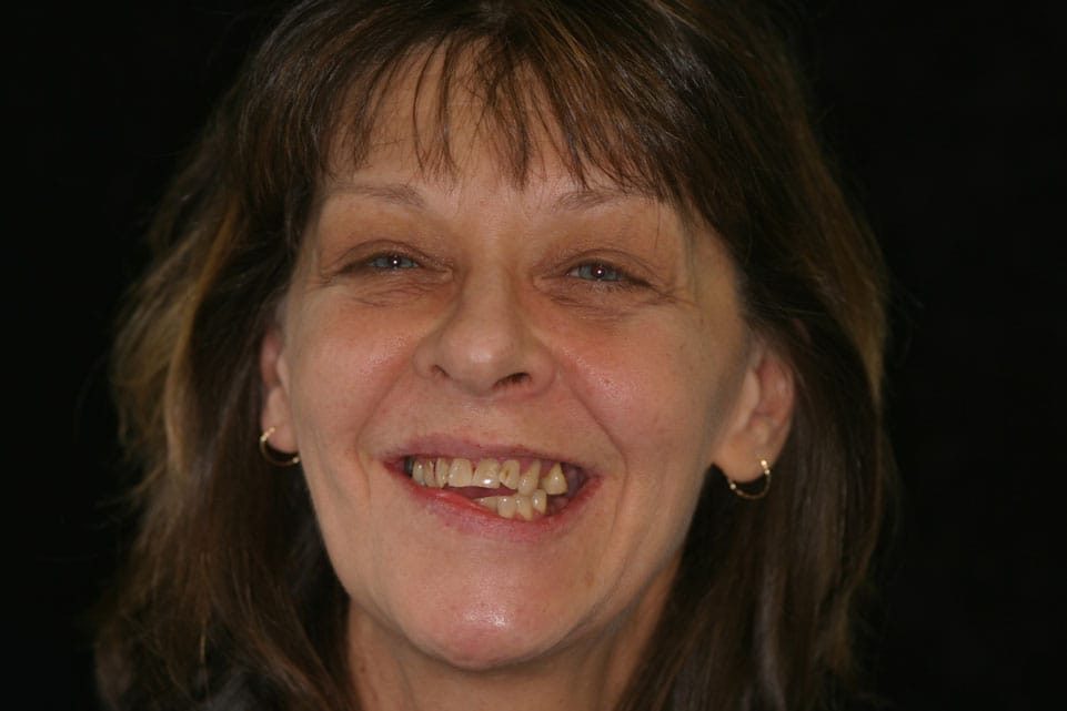 Rasner Smile gallery before 22