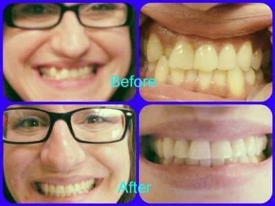 Before and after