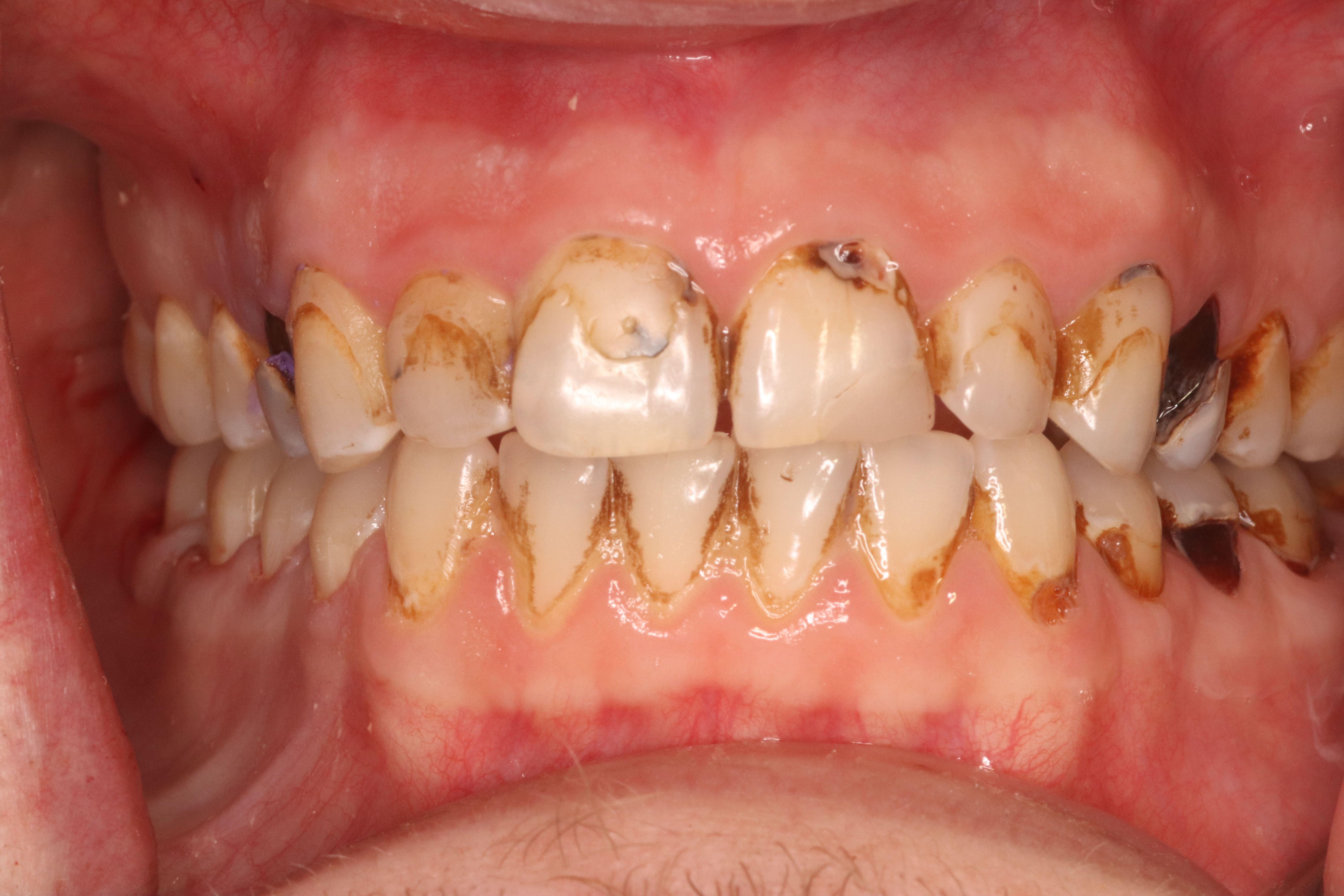 Rasner Smile gallery before 5