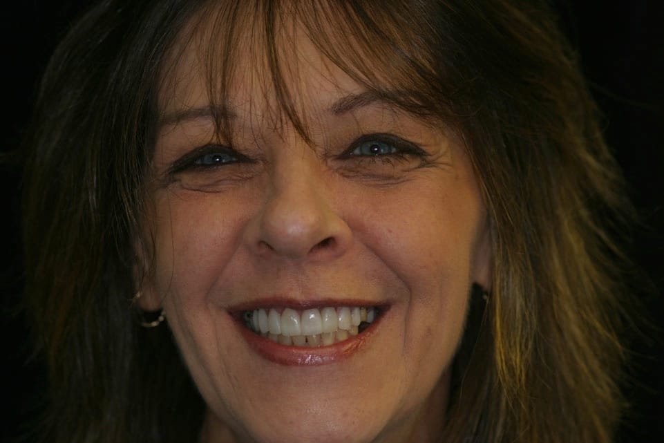 Rasner Smile gallery after 22