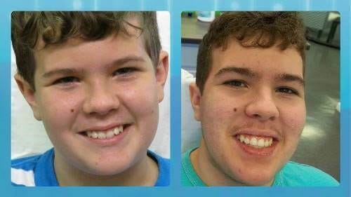Before and after
