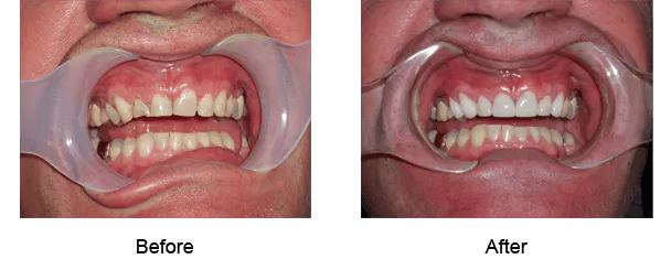 Smile Galley Before and After
