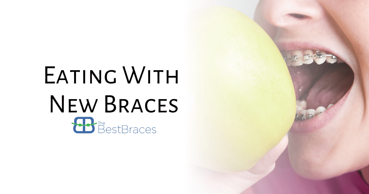 Eating With New Braces