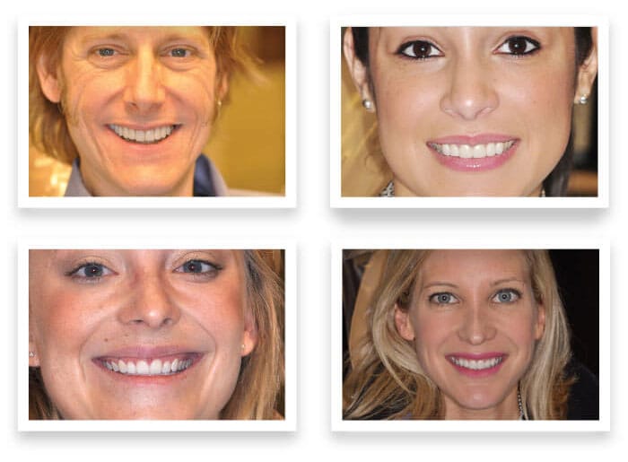 Photographs of some smiles