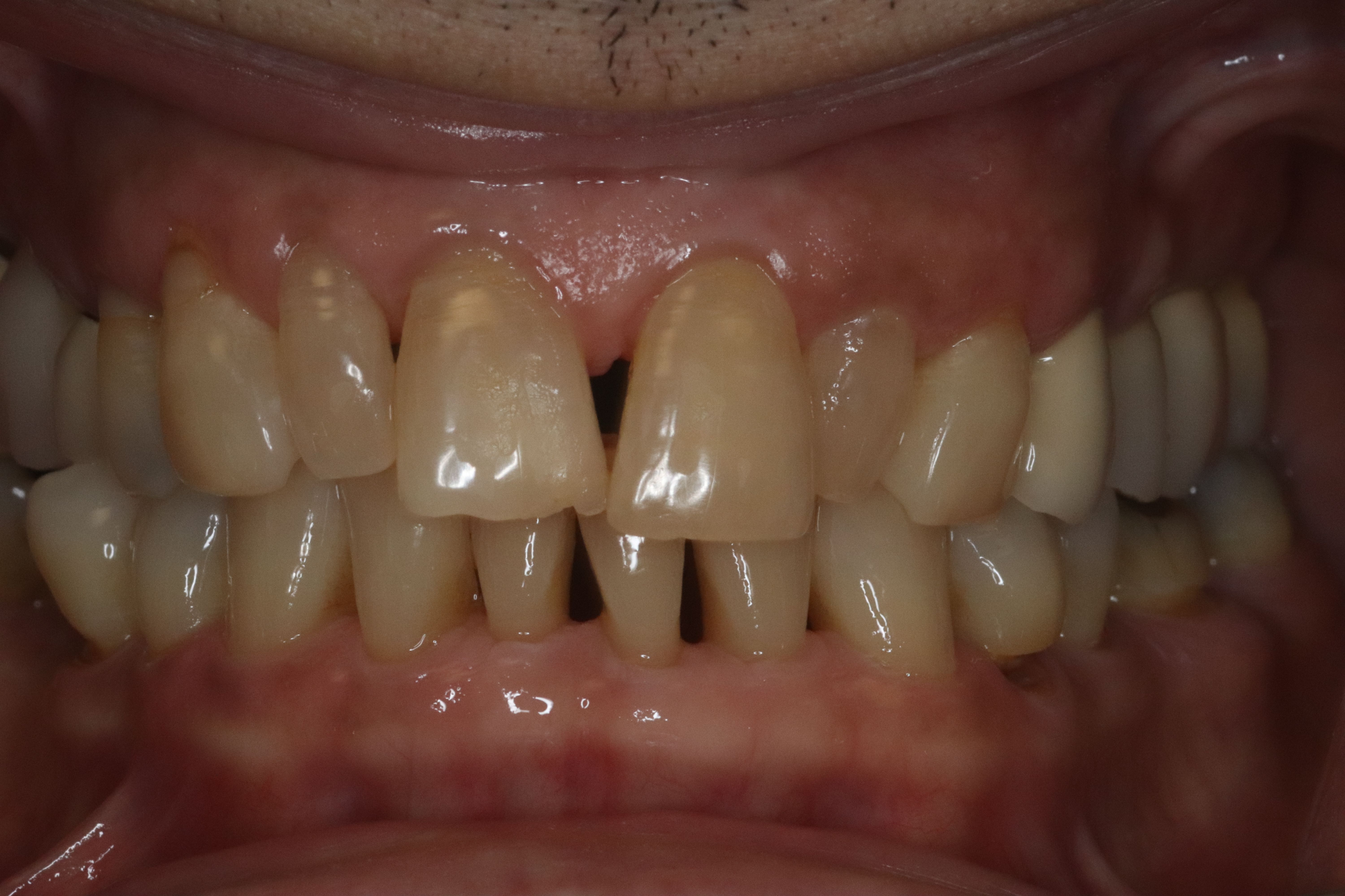 Rasner Smile gallery before 6