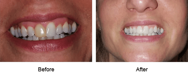 Smile Galley Before and After