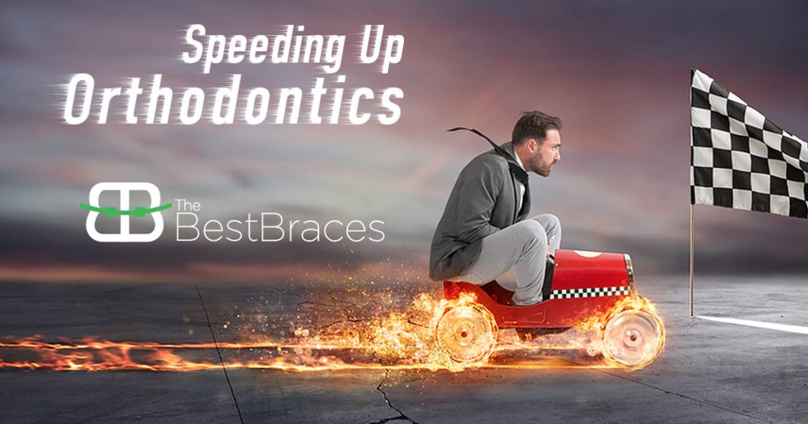 Speeding Up Orthodontics