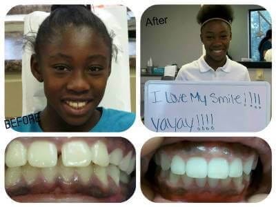 Before and after