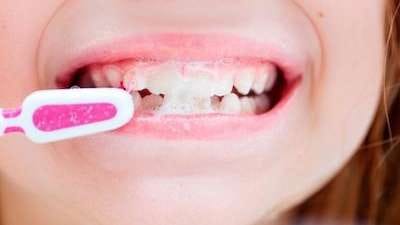 Childs Teeth Brushing Childs Teeth Brushing