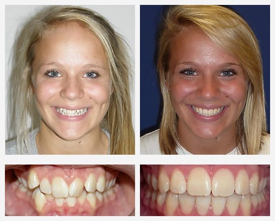 Smile Gallery Photo 2