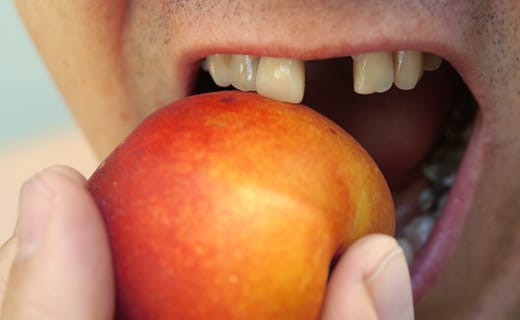 Why Wearing Dentures Will Make You Smile