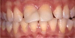 Patient 25600 Before Photo
