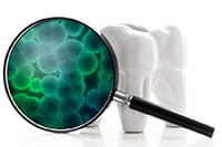 Magnifying glass showing dental plaque buildup on teeth illustration