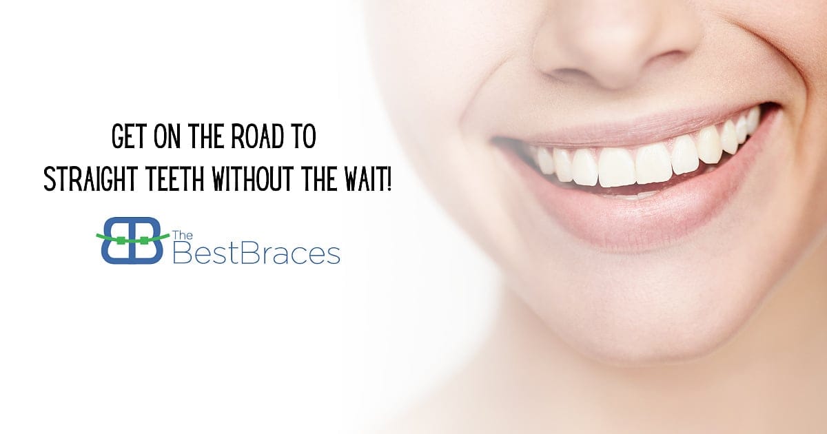 Get On The Road To Straight Teeth Without The Wait!