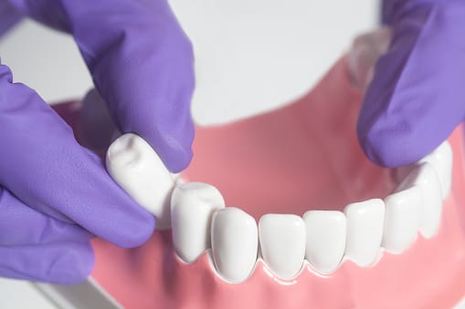 TOOTH EXTRACTION POST-OP CARE?