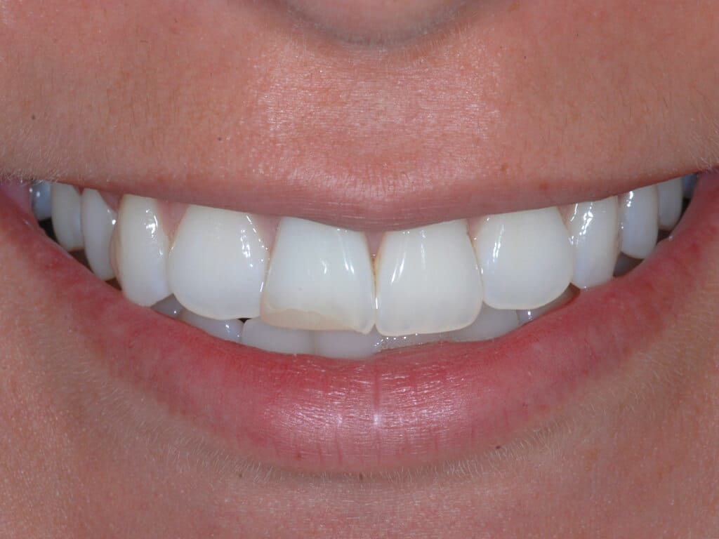 Virginia DC case 79 before