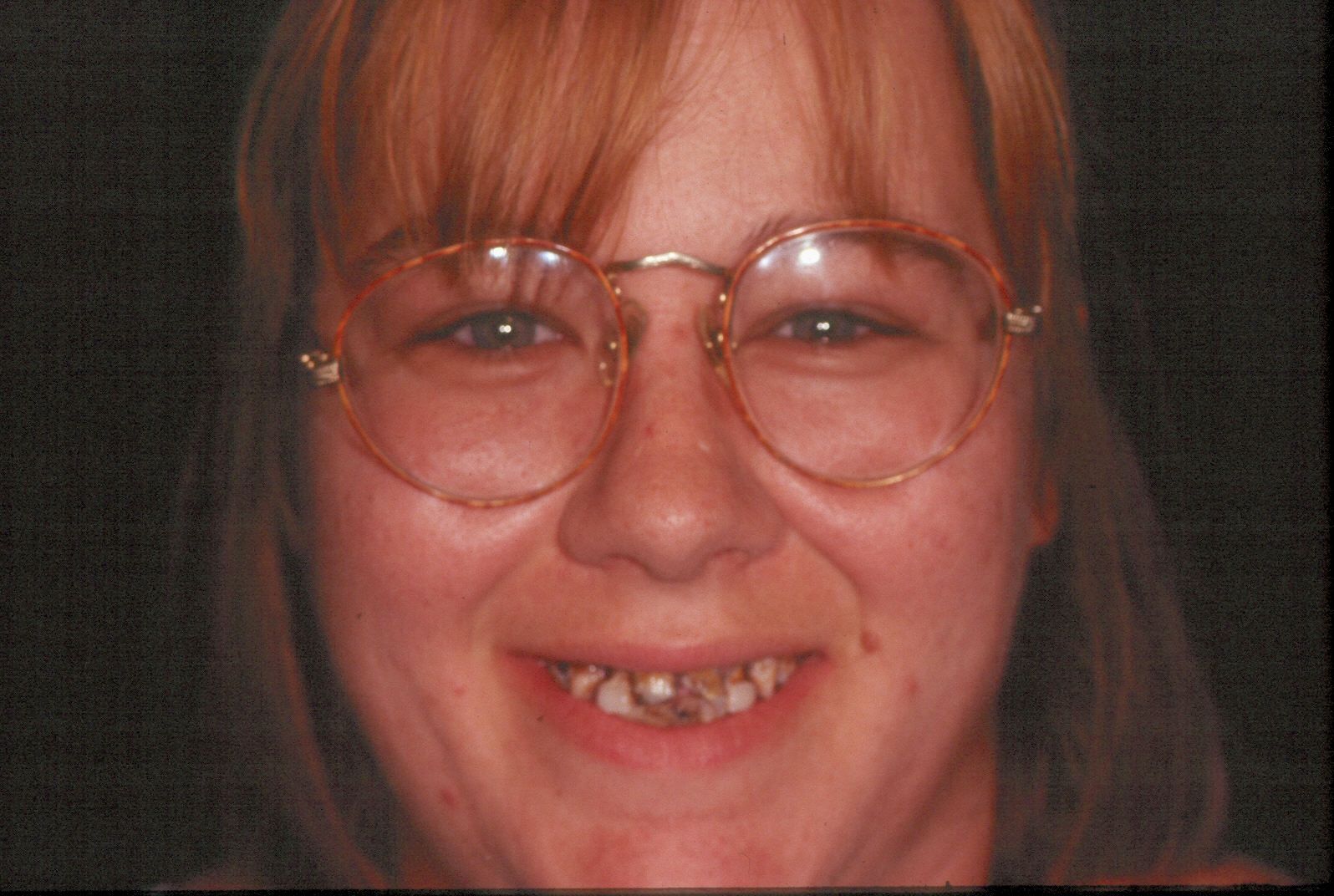 Rasner Smile gallery before 15