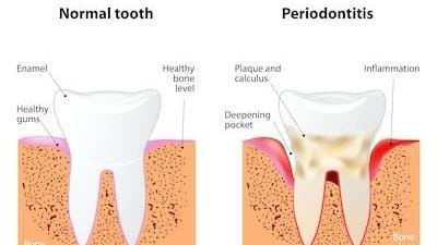 Healthy Smile Healthy Smile