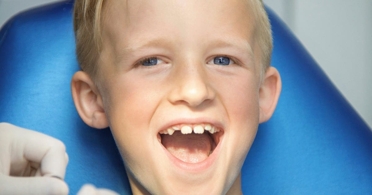 The Natural Appeal of Tooth-Colored Fillings in Pediatric Dentistry The Natural Appeal of Tooth-Colored Fillings in Pediatric Dentistry