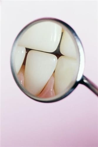 Mouthwash adds extra hygienic punch after brushing and flossing