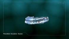 Sleep Appliances - Sleep Apnea 001