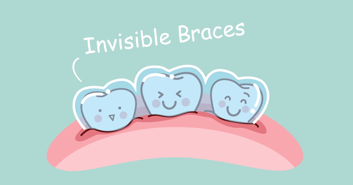 A Parent’s Guide to Invisalign for Teens