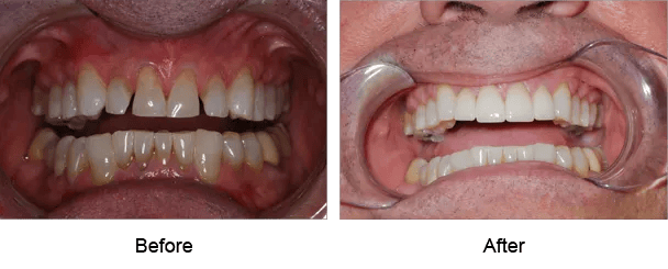 Smile Galley Before and After