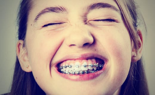 How Do I Take Care of My Teeth During Orthodontic Treatment? How Do I Take Care of My Teeth During Orthodontic Treatment?