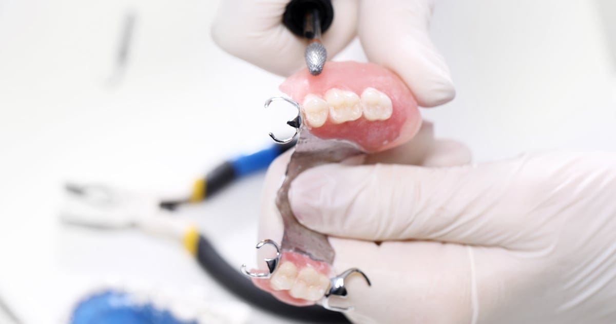 A Complete Comparison of Dental Bridges and Dental Implants A Complete Comparison of Dental Bridges and Dental Implants