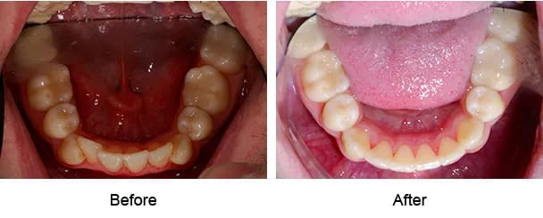 Smile Galley Before and After