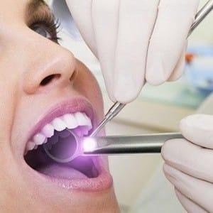 oral cancer screening
