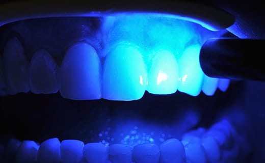 Critical Facts About Gum Disease Critical Facts About Gum Disease